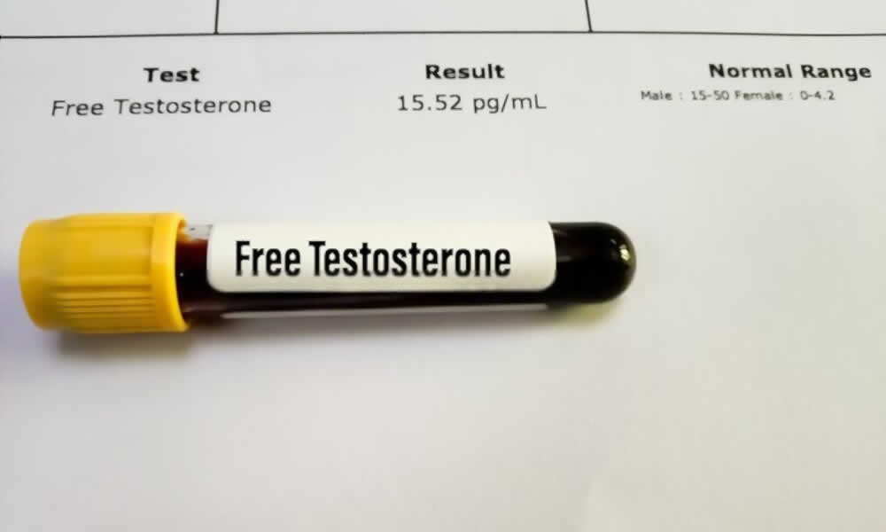 Teste de testosterona
