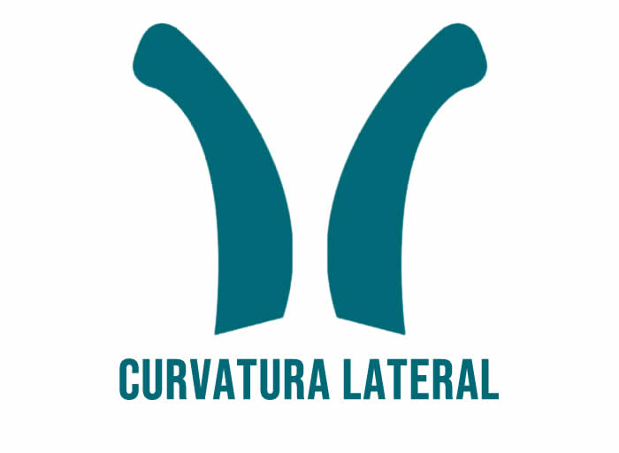 Curvatura lateral